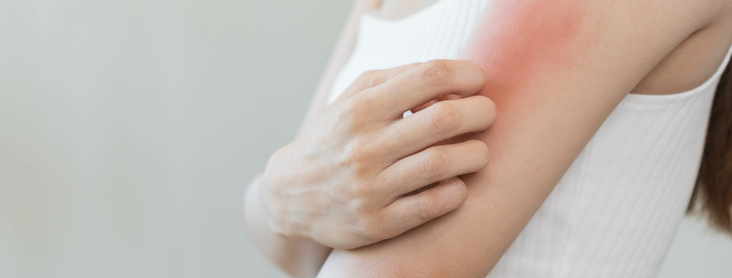 7 Effective Solutions for Perimenopause Itchy and Dry Skin